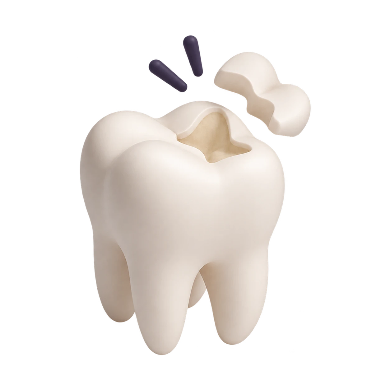 Модель зуба с отделённым старым композитным элементом